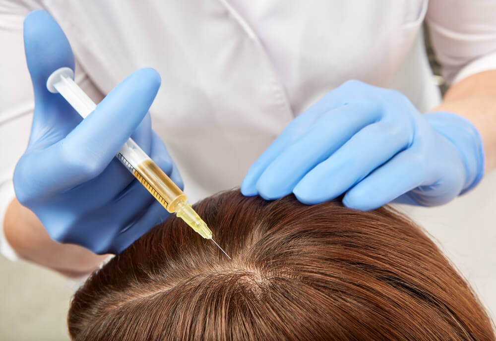 hair prp in islamabad