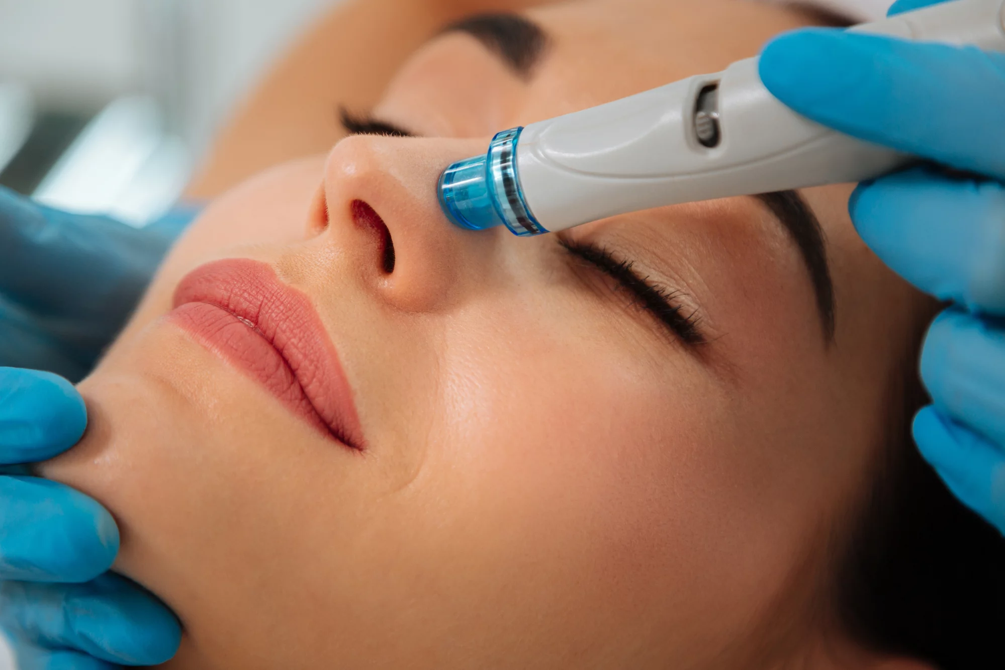 hydrafacial in islamabad