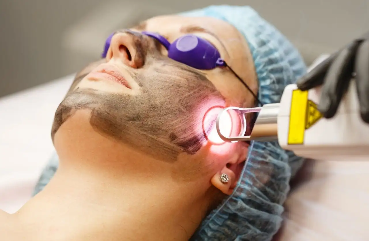 laser treatment in Islamabad